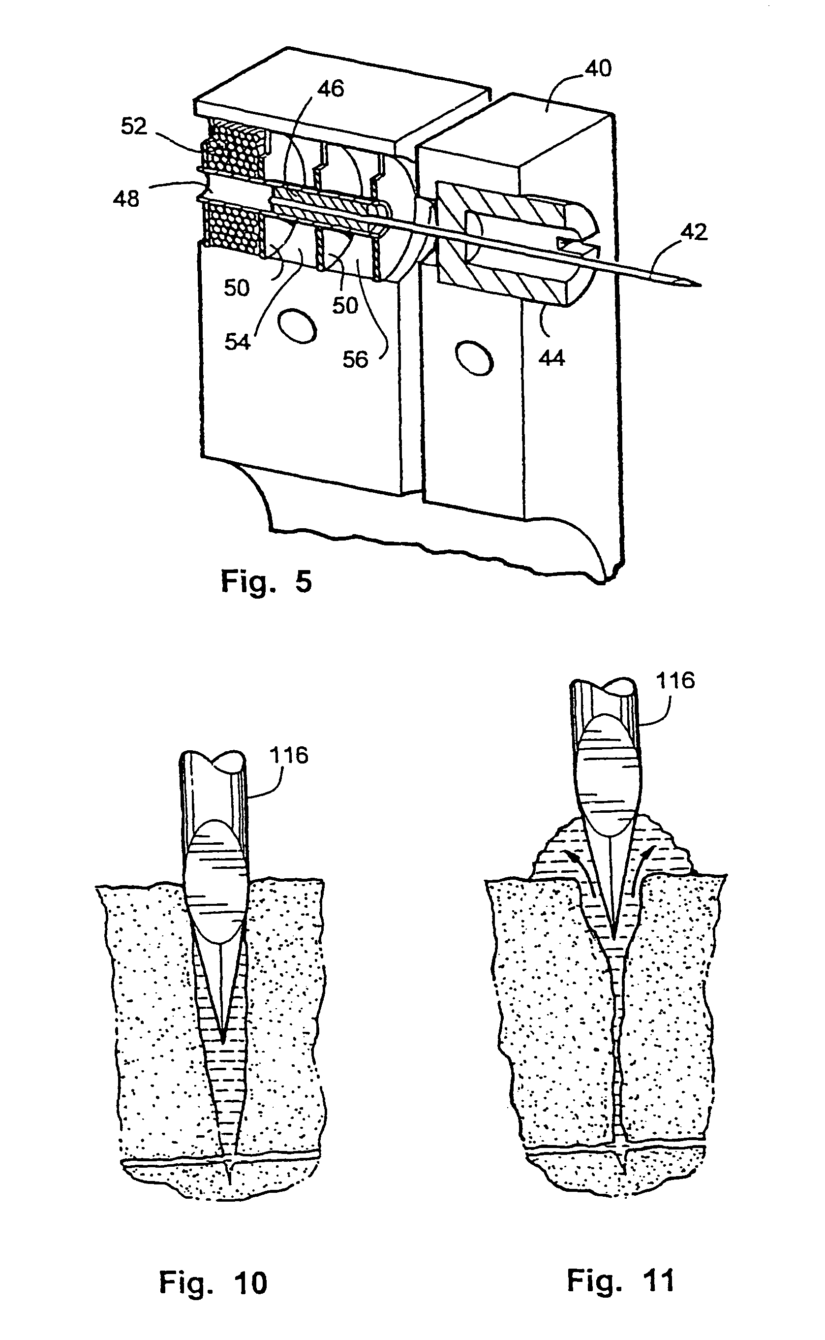 Tissue penetration device