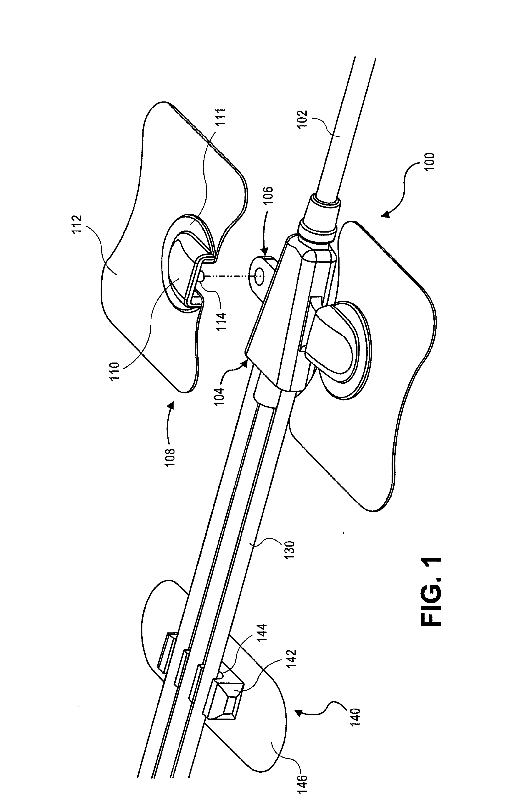 Catheter securement devices