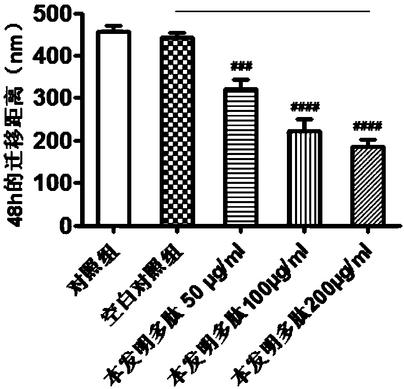 Polypeptide used for inhibiting oral squamous cell carcinoma migration and invasion capacities and application thereof