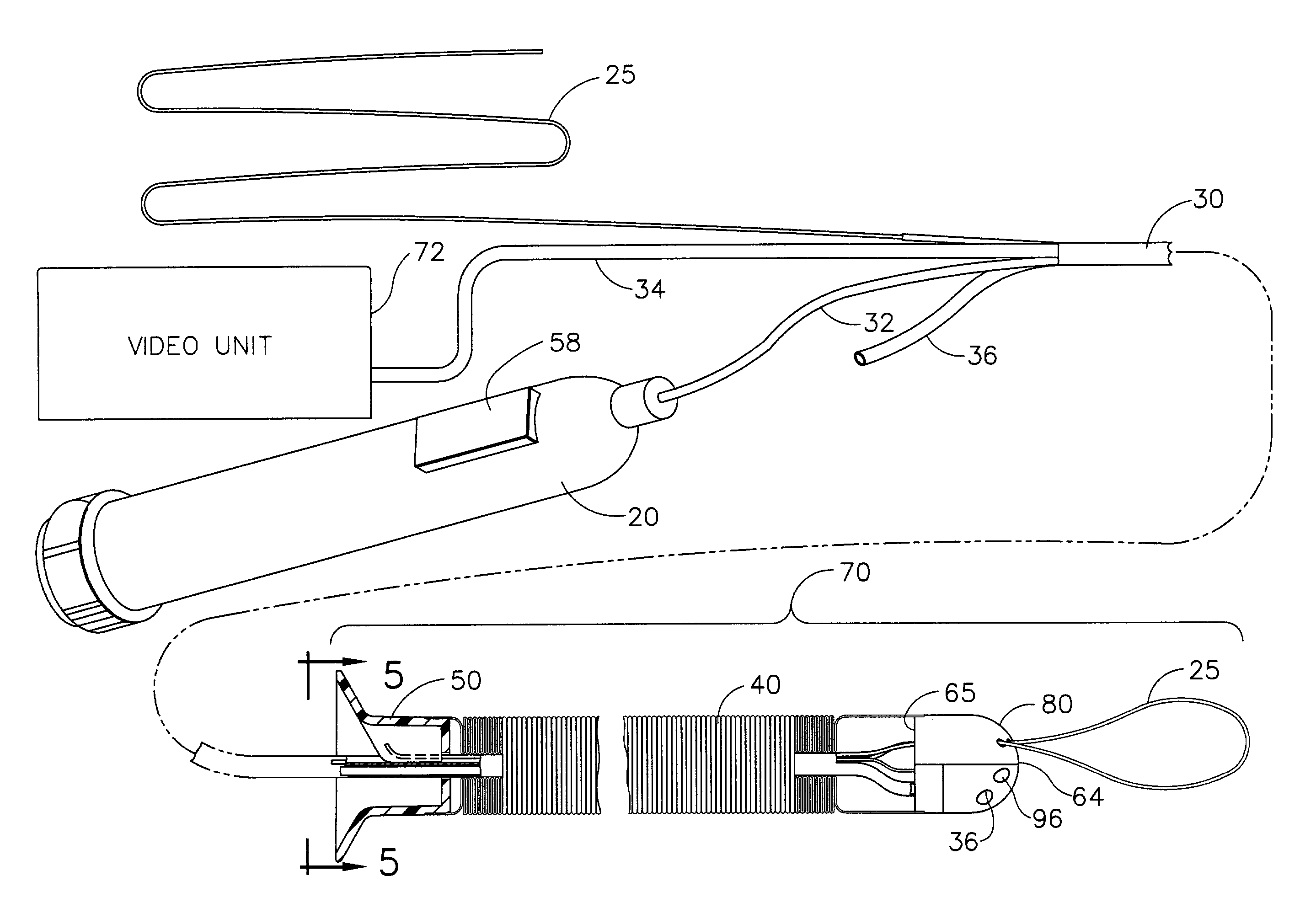 Locally-propelled, intraluminal device with cable loop track and method of use