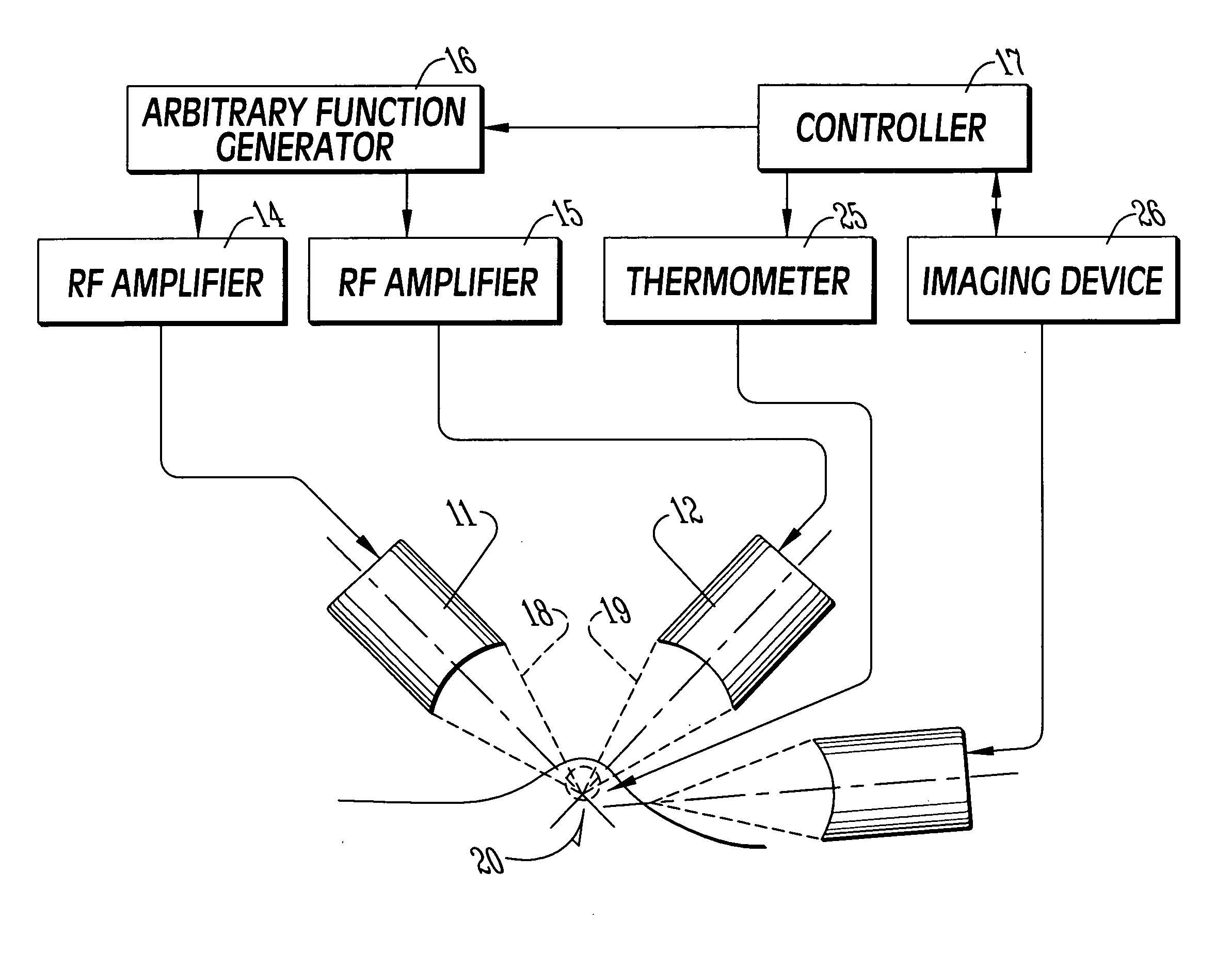 Multiple-angle switched high intensity focused ultrasound