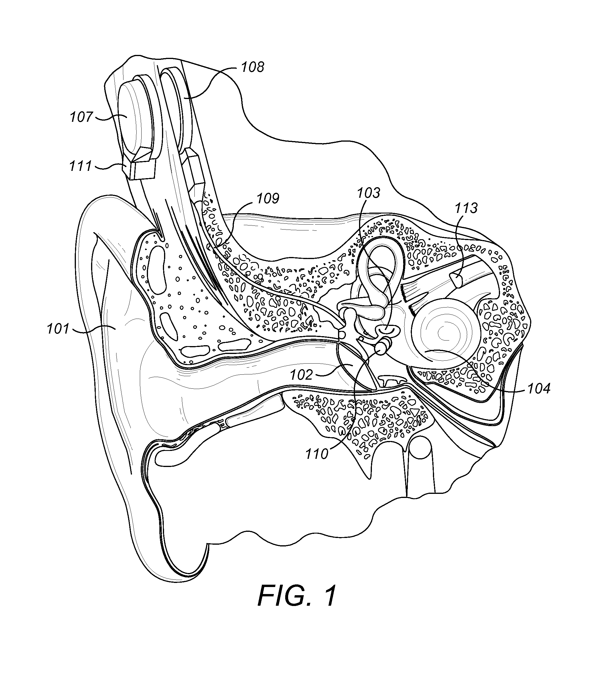 Optimal pre-load for floating mass transducers