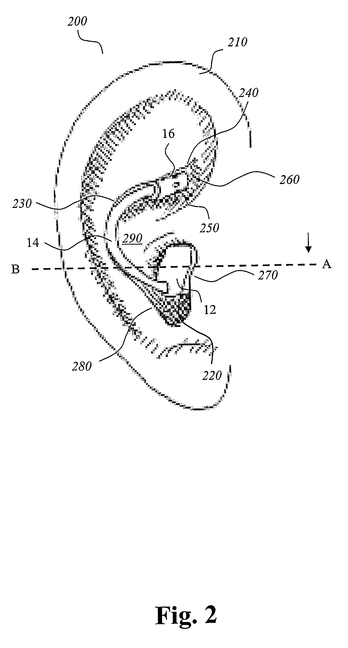 Modular hearing instrument
