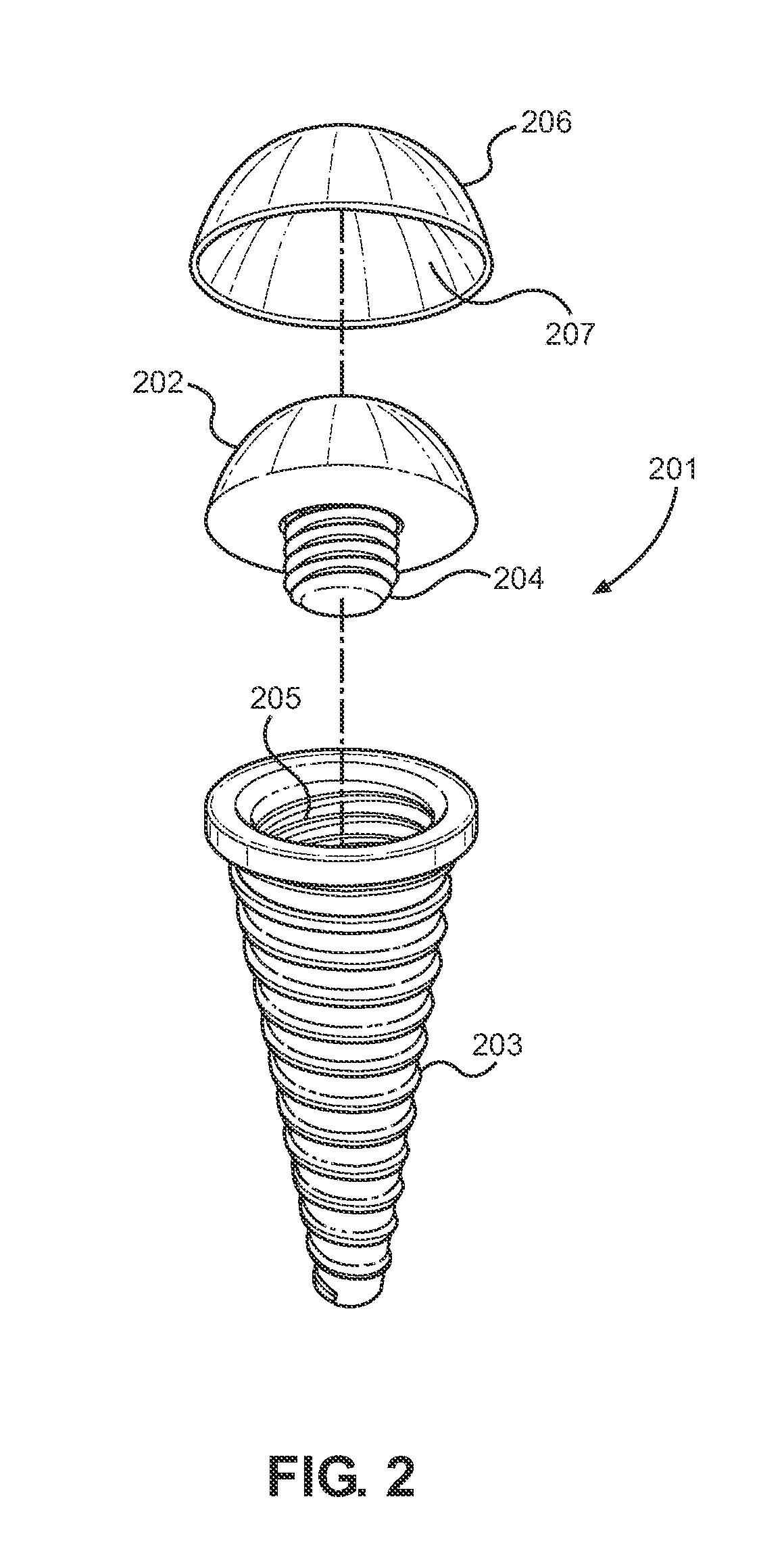 System and Method of Installing Dental Prostheses for Passively Influencing Tongue Position to Reduce Airway Obstruction