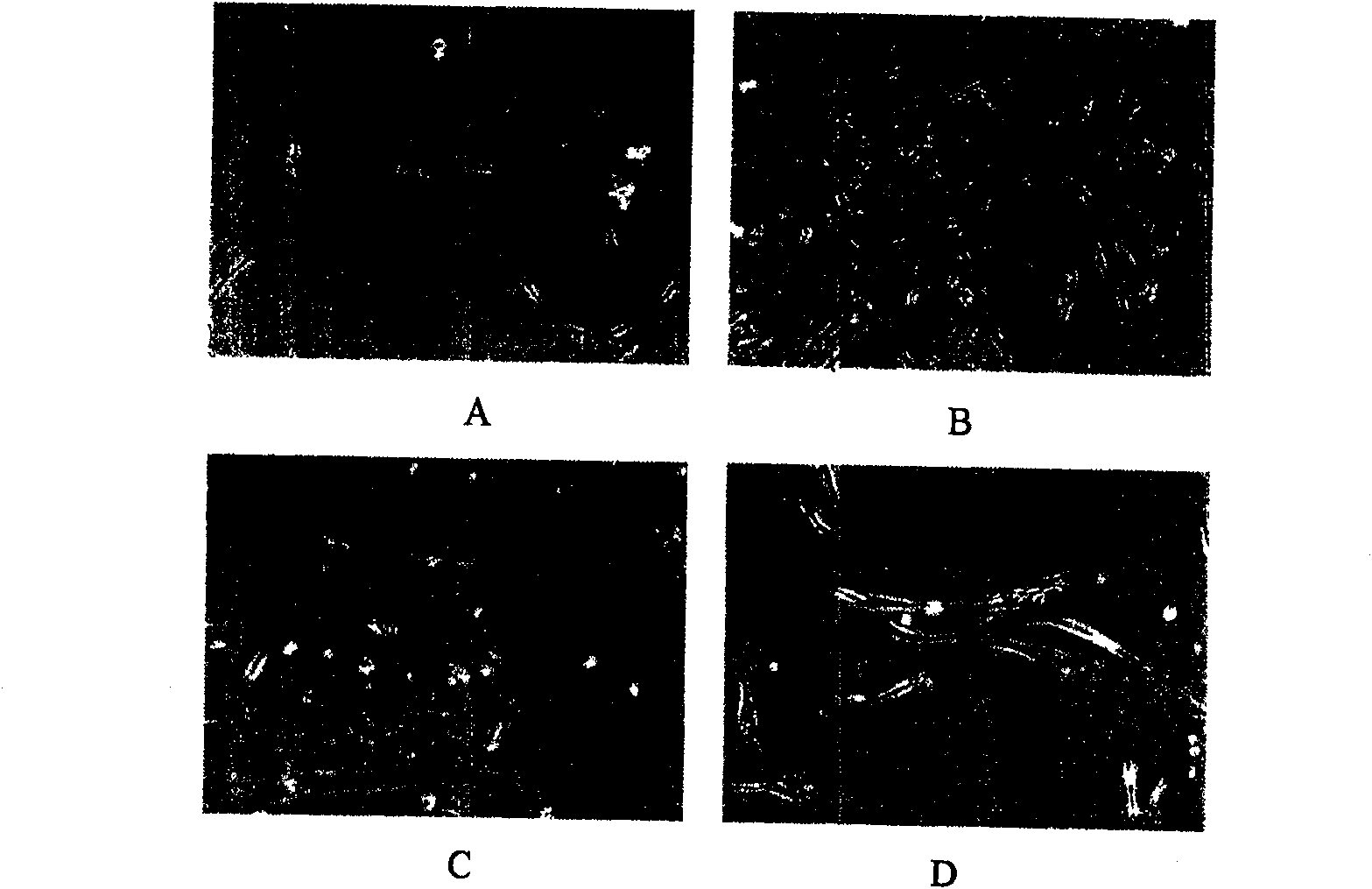 Method for sorting human marrow mesenchymal stem cell by monoclonal antibody ZUE12 immunomagnetic bead