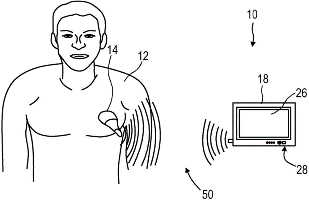 Mobile 3D wireless ultrasound image acquisition device and ultrasound imaging system