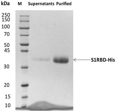 Human antibody binding to coronavirus RBD and application of human antibody