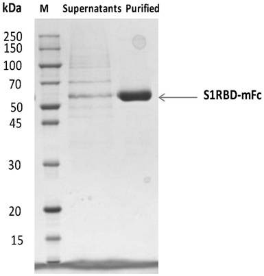Human antibody binding to coronavirus RBD and application of human antibody