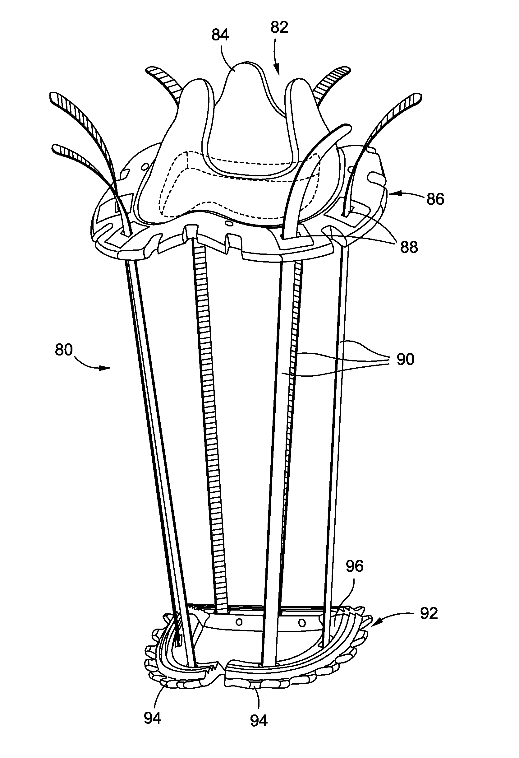 Heart valve prosthesis anchoring device and methods