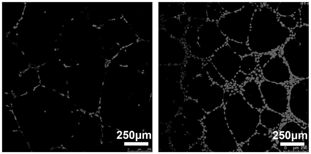 Preparation method of nano-mesoporous composite flexible membrane material for promoting blood vessel formation