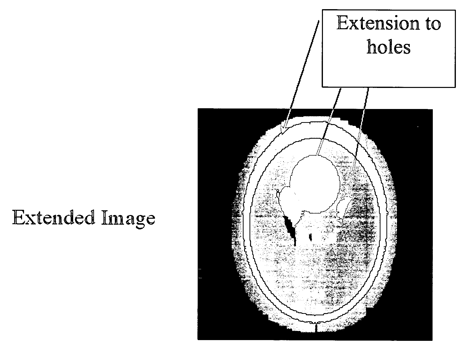 Method for image intensity correction using extrapolation and adaptive smoothing