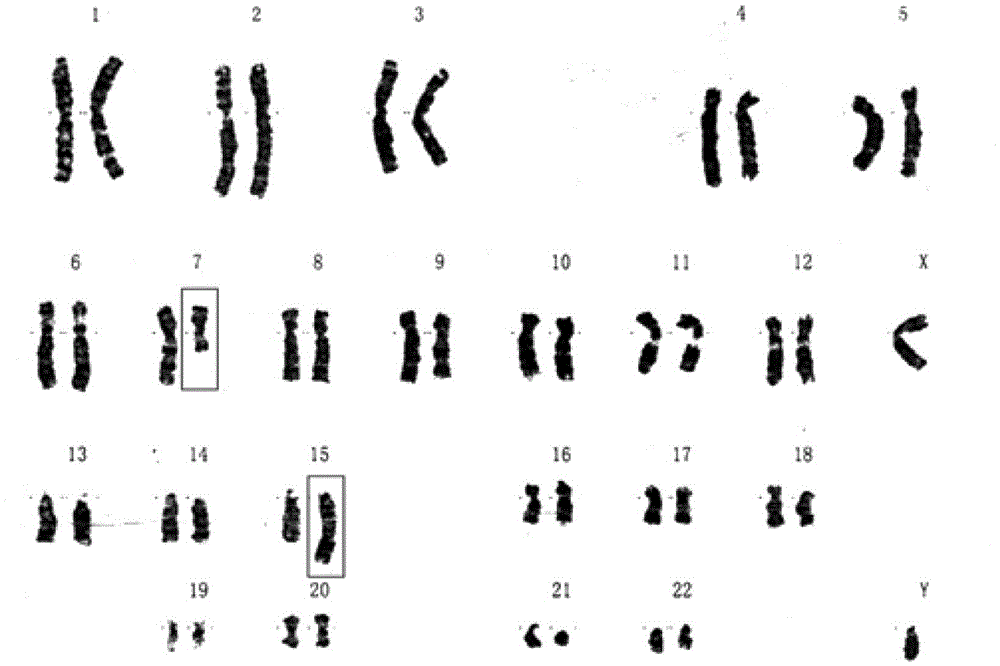 Method for detecting variation of copy numbers of genomes