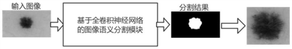 Method and system for tissue segmentation of melanoma images based on deep neural network