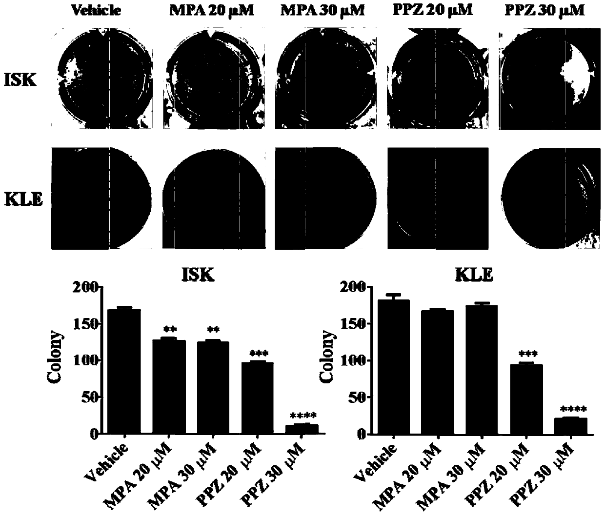 Application of perphenazine in preparing medicament for treating endometrial carcinoma