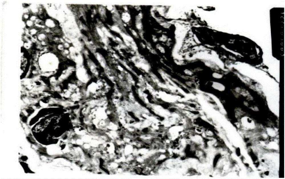 Medicinal composition as well as preparation method and applications thereof