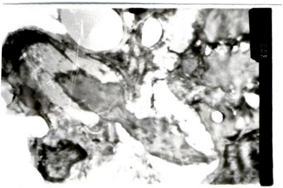 Medicinal composition as well as preparation method and applications thereof