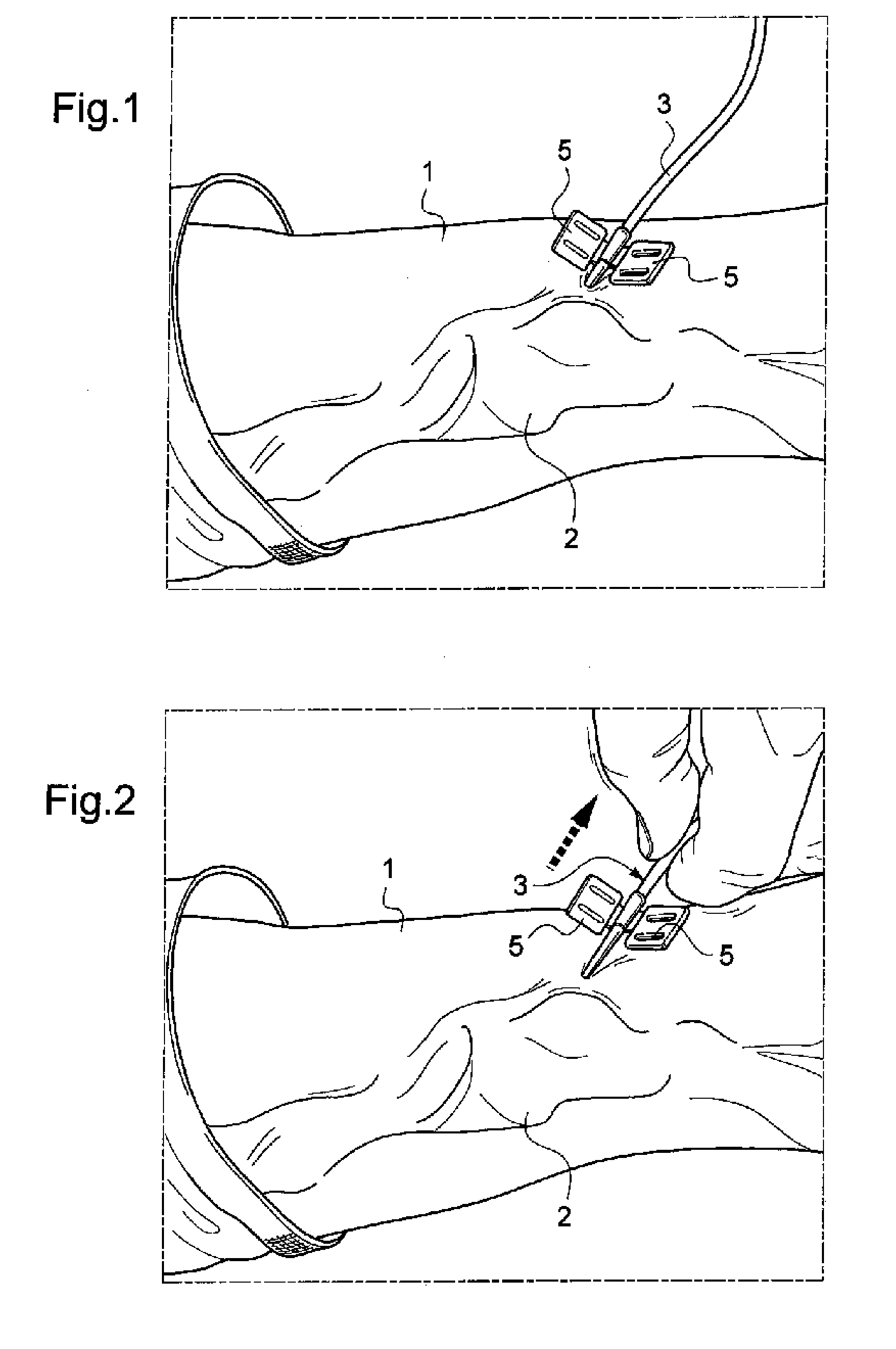 Medical device for a puncture site or infusion site