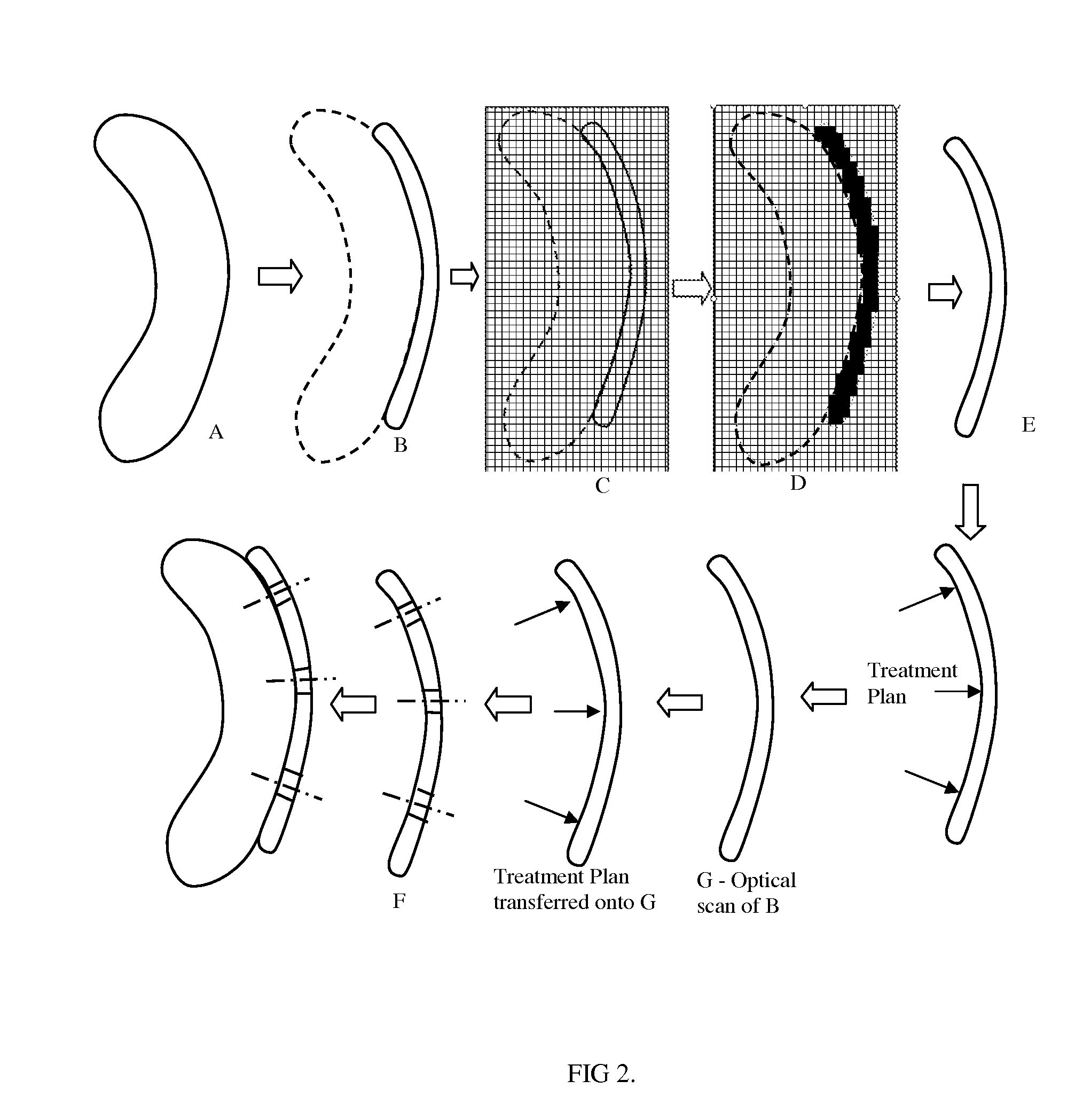 Design method of surgical scan templates and improved treatment planning