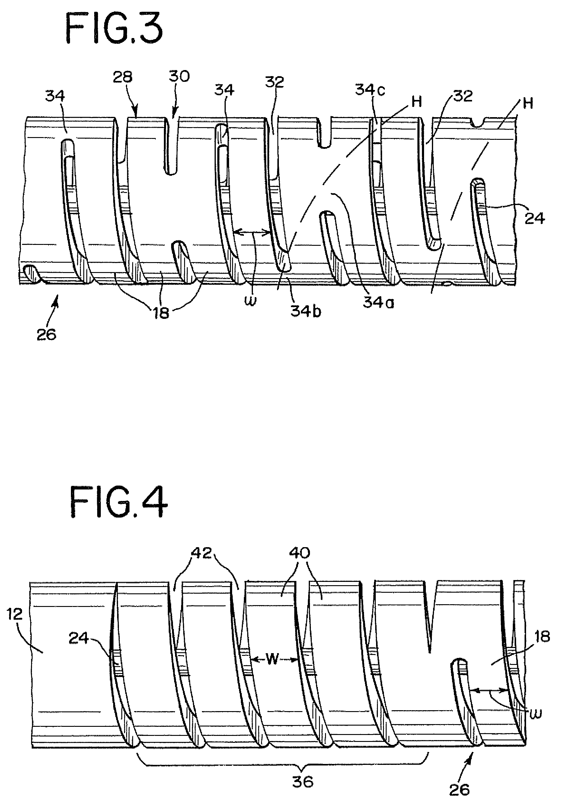 Interventional medical device system having an elongation retarding portion and method of using the same