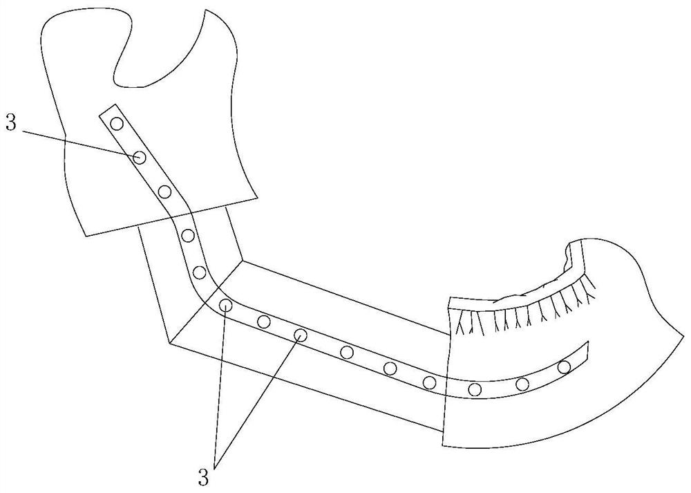 Manufacturing method of 3D printed fibular reconstruction jaw surgical tool combined with bone resection and titanium plate positioning