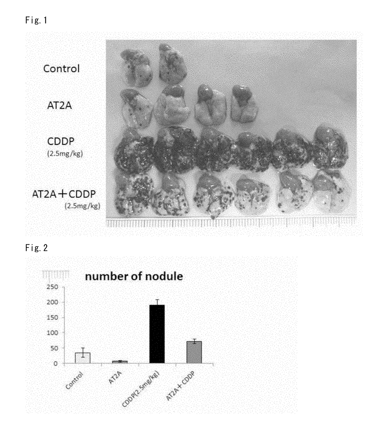 Medicament for suppressing malignant tumor metastasis