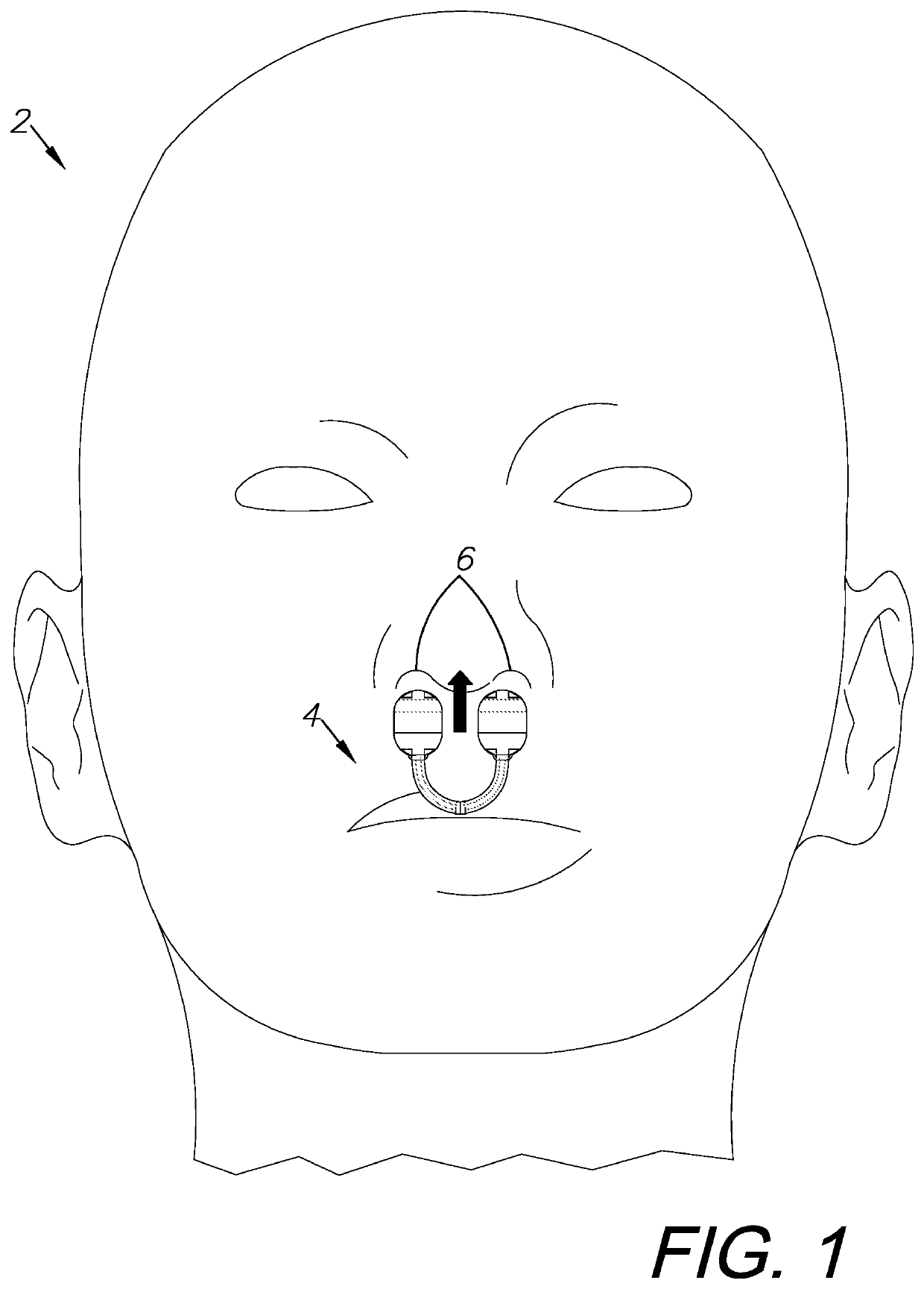 Wearable intranasal clip apparatus and method of use