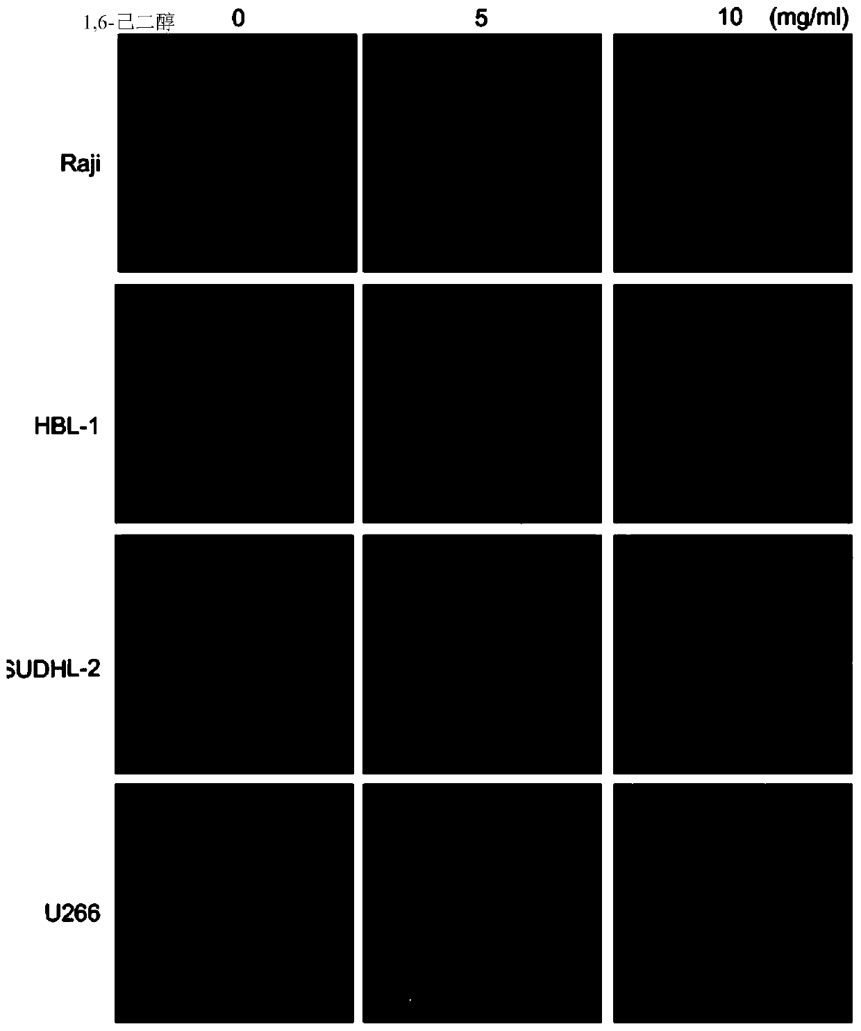 Application of 1,6-hexanediol or its derivatives in the preparation of anti-blood tumor drugs