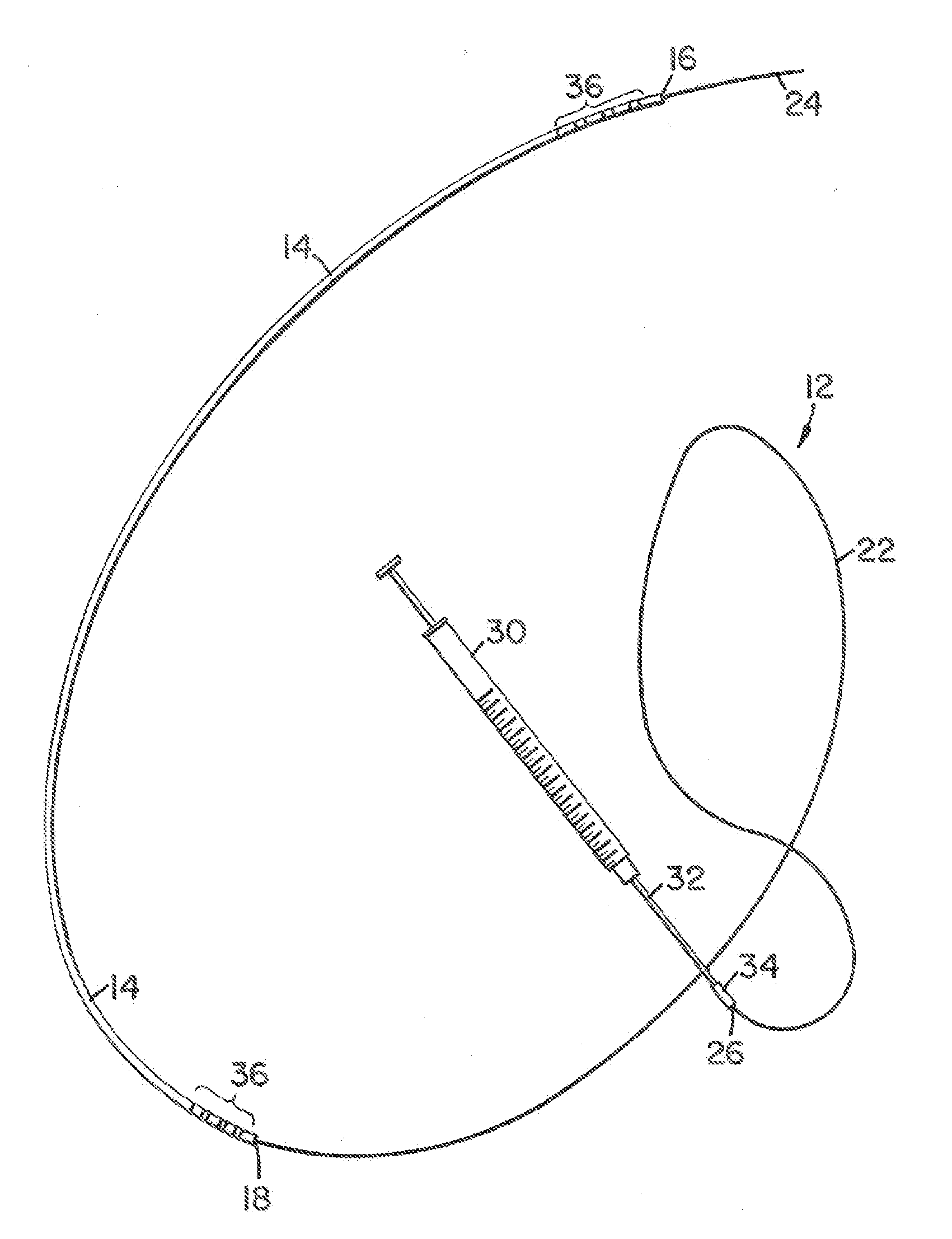 Infusion device and method for infusing material into the brain of a patient