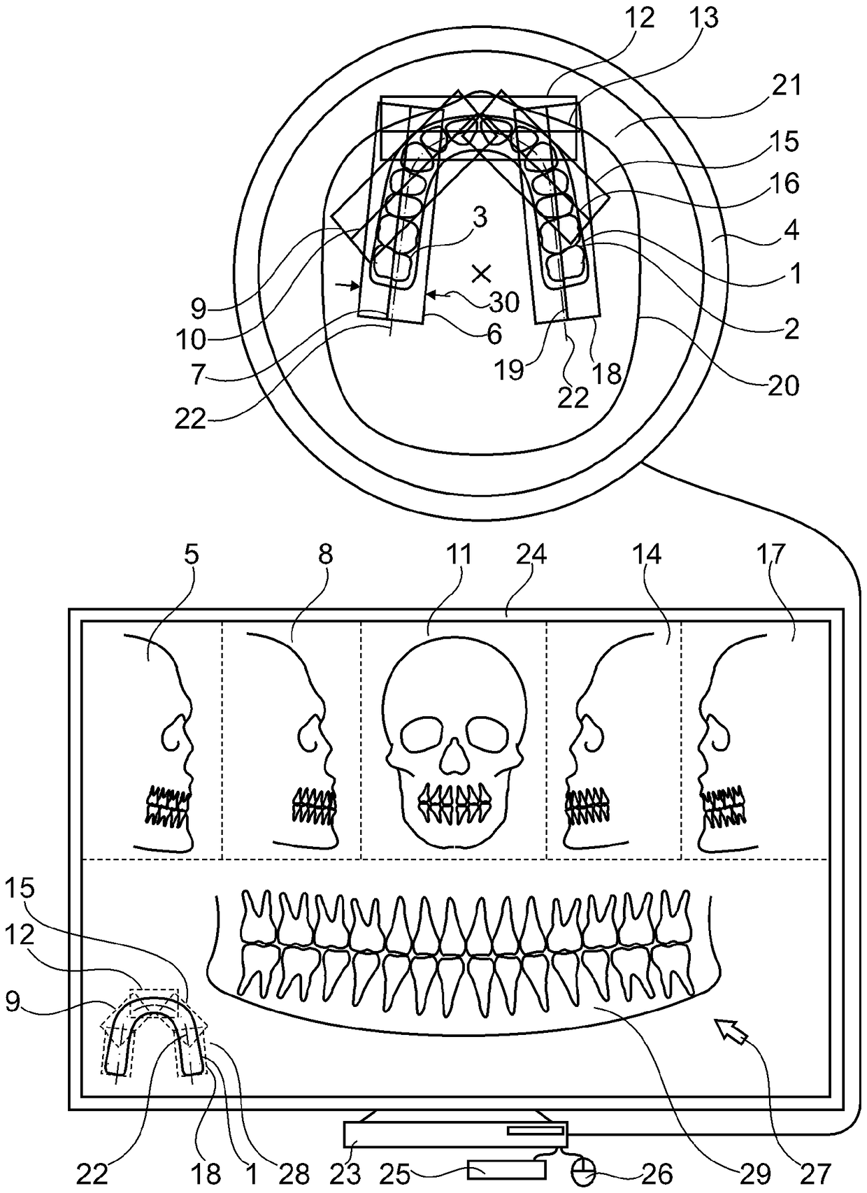 Method for detecting a dental object
