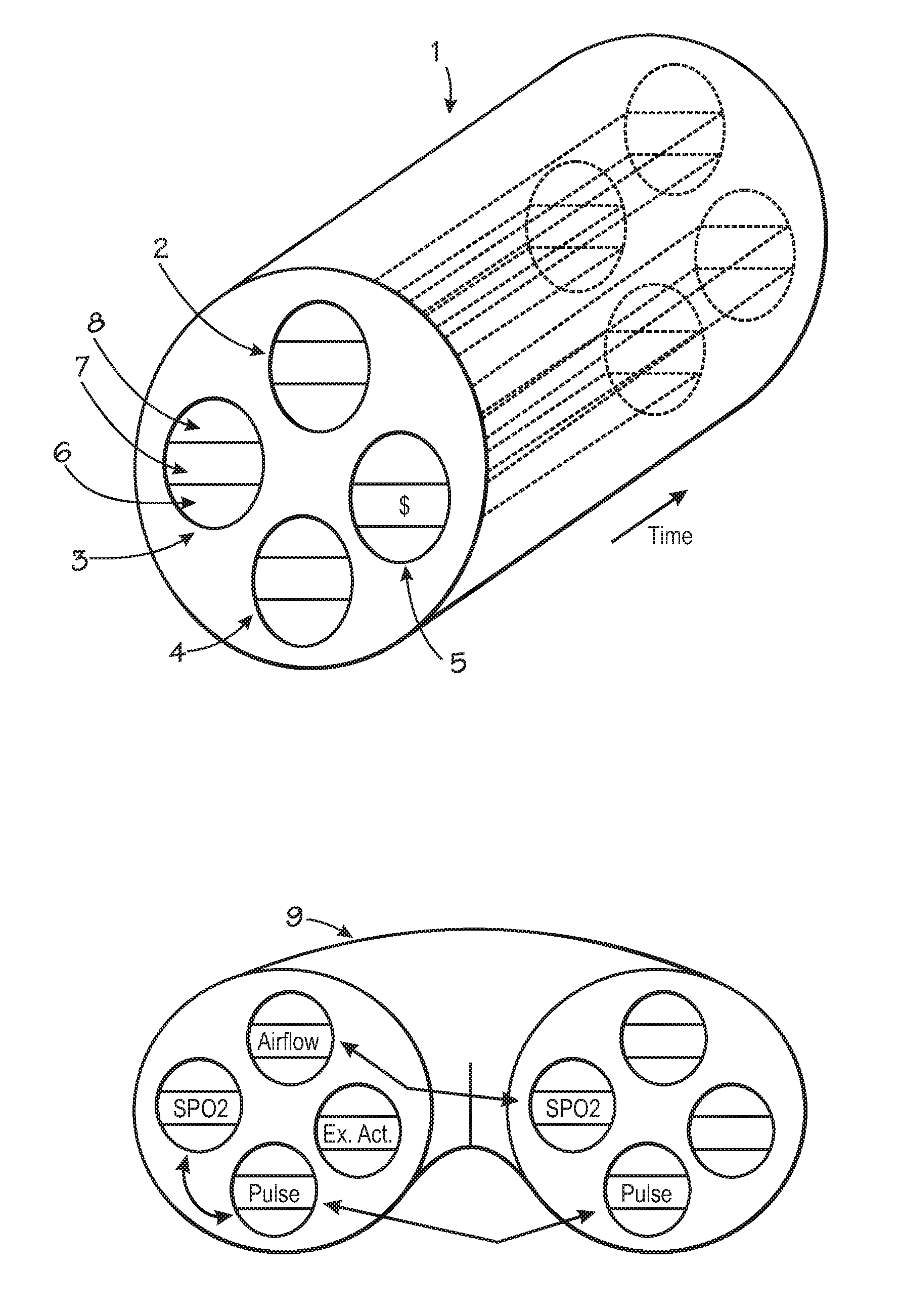 Centralized hospital monitoring system for automatically detecting upper airway instability and for preventing and aborting adverse drug reactions