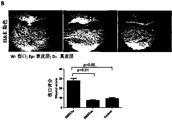 Stem cell ointment used for treating skin damages, and preparation method thereof
