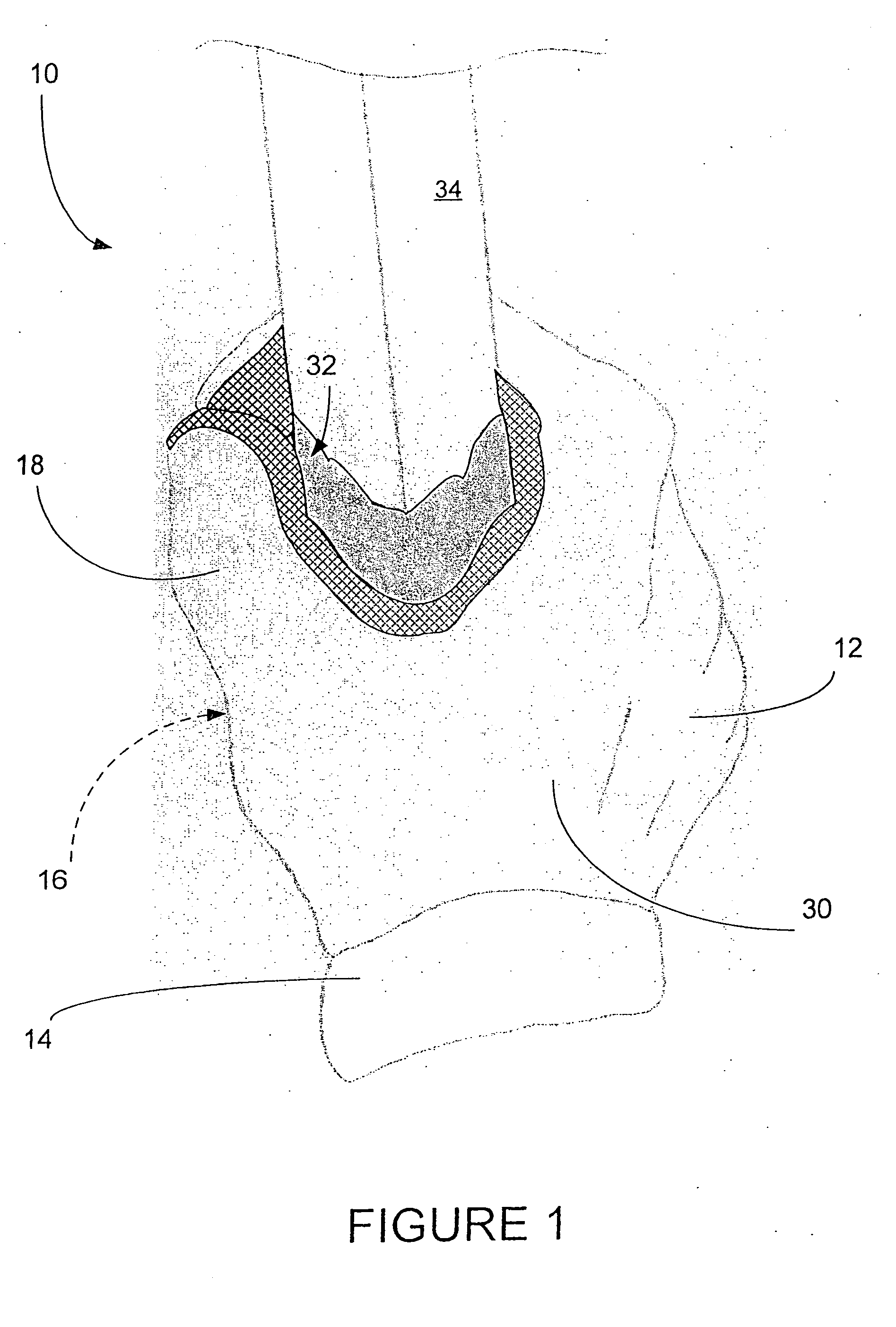 Applicator device for paint and surface coatings