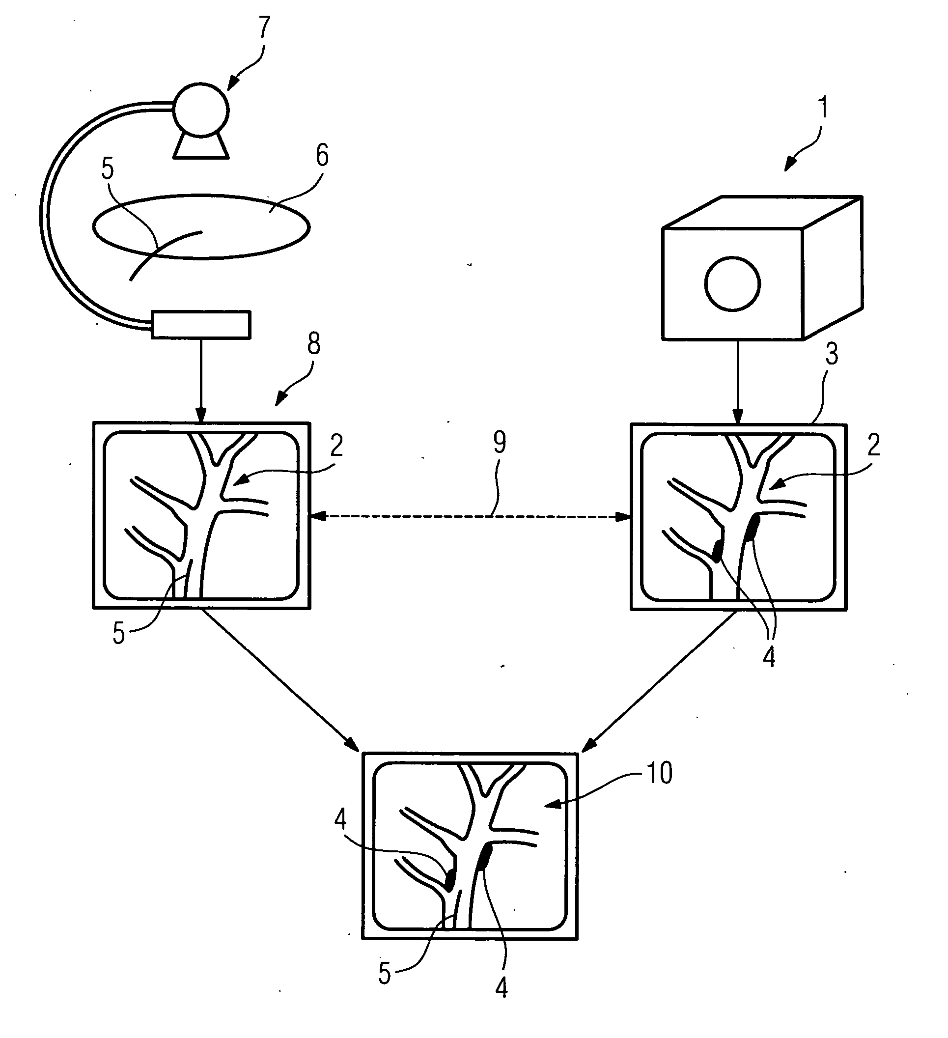 Method for supporting navigation of a medical instrument, in particular of a catheter