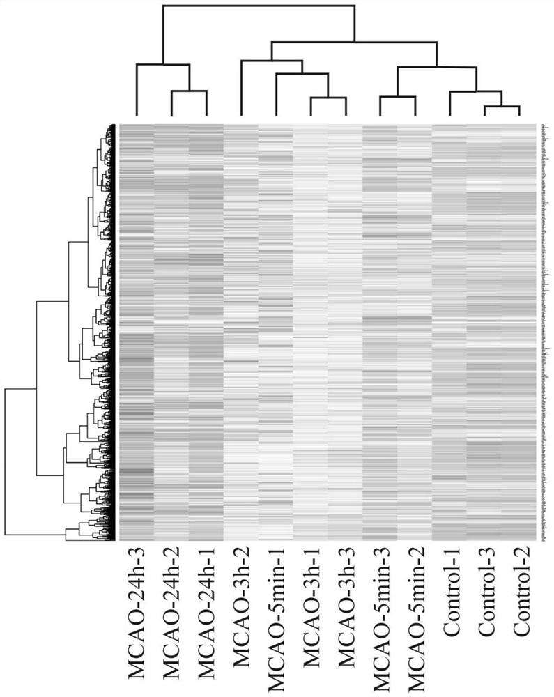 Application of circular RNA CircOGDH as acute ischemic stroke treatment target