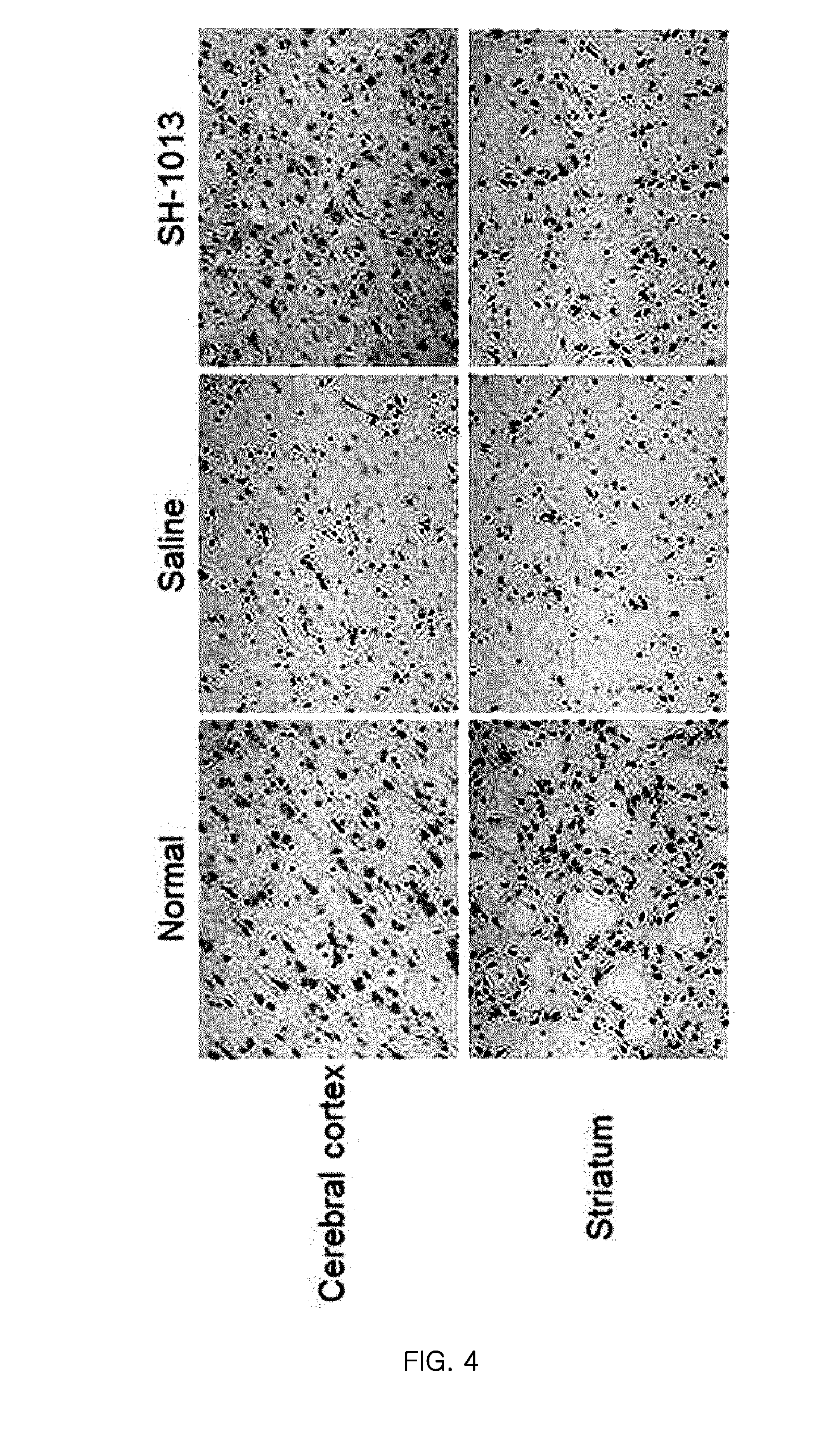 Pharmaceutical Composition or Health Food Comprising Lonicera Coerulea Var. Edulis Fruit Extracts as Active Ingredients for Preventing or Improving Ischemic Cerebrovascular Diseases