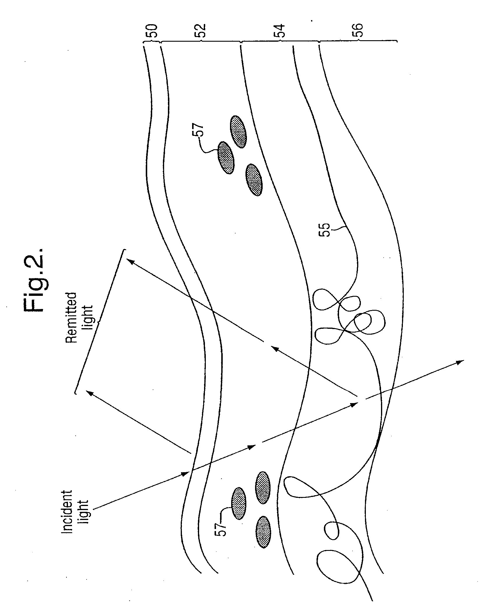 Method and Apparatus for Detecting the Presence of Dermal Melanin in Epithelial Tissue