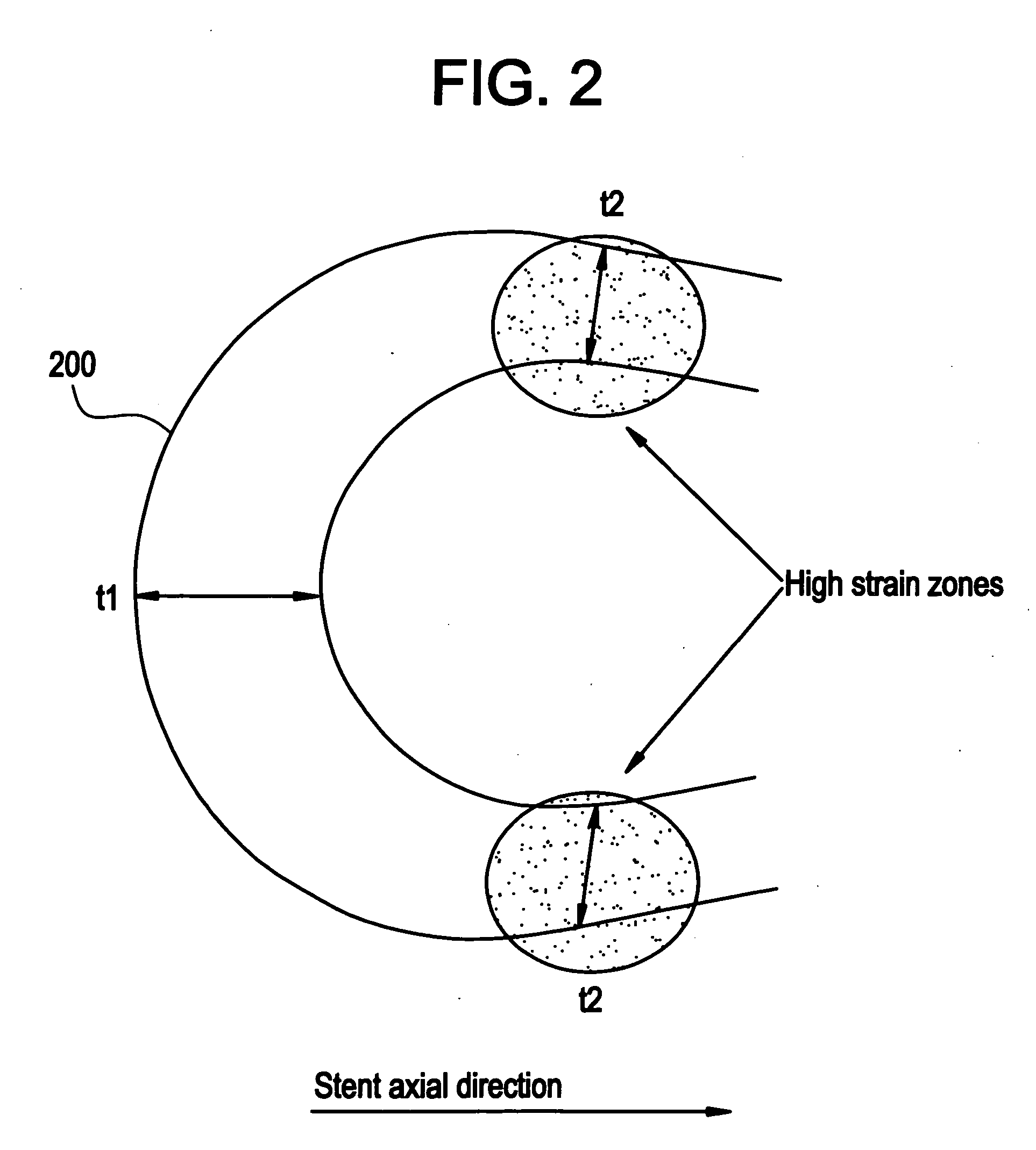 Polymeric stent having modified molecular structures in selected regions of the hoops and method for increasing elongation at break