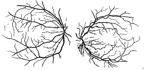 A blood vessel segmentation method for fundus images based on layered matting algorithm