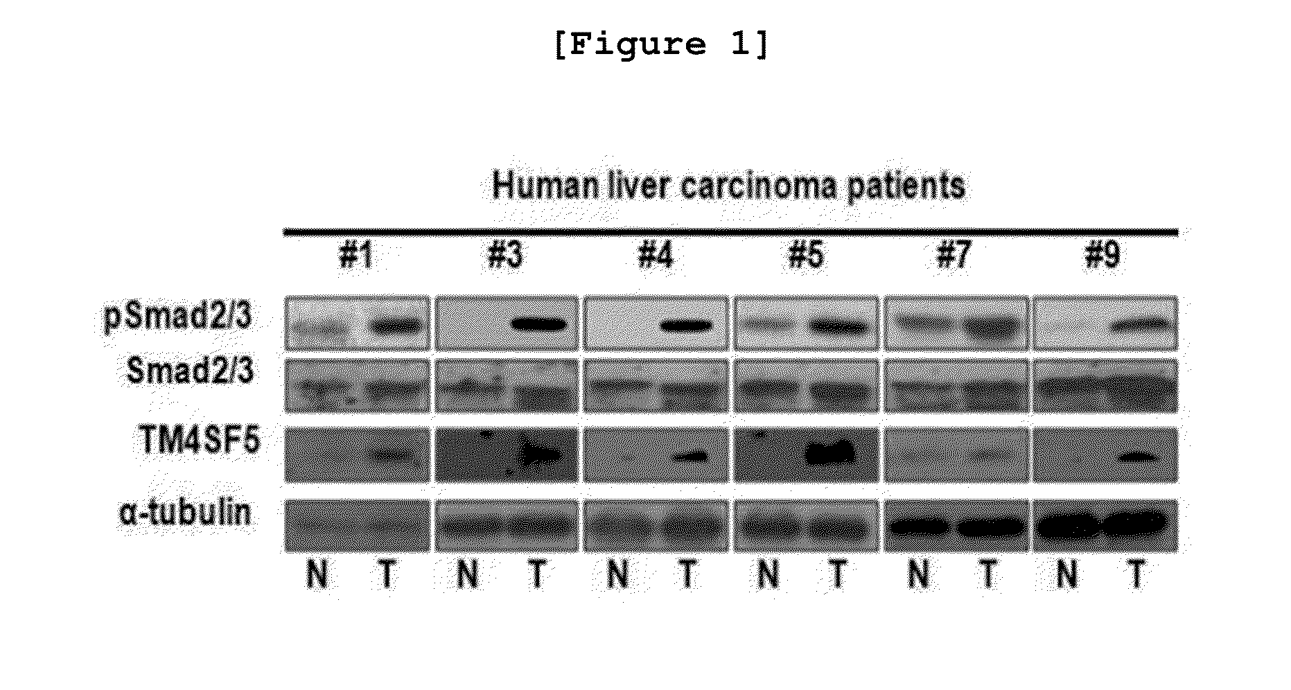 Composition for diagnosing, treating, and preventing liver disease