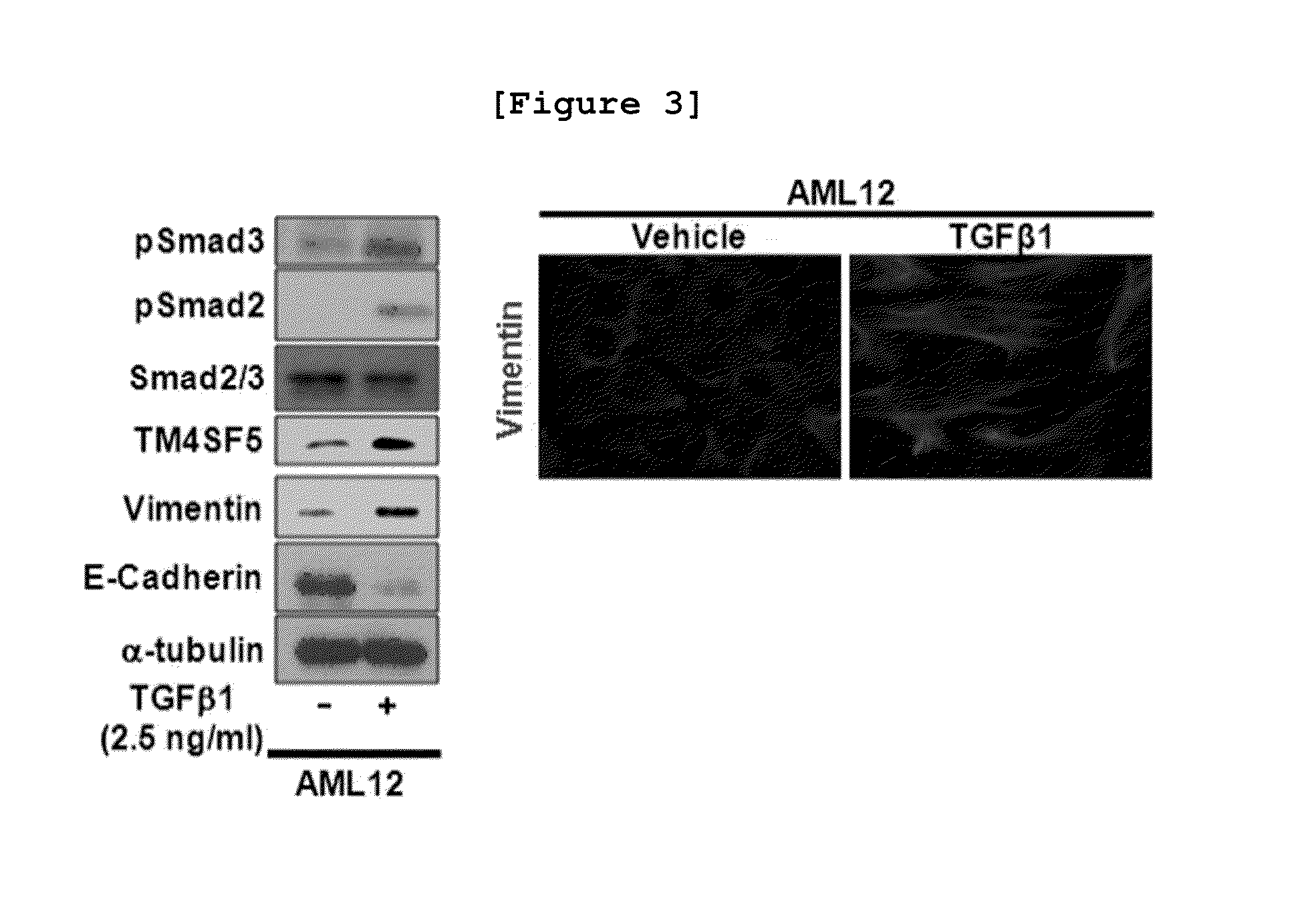 Composition for diagnosing, treating, and preventing liver disease
