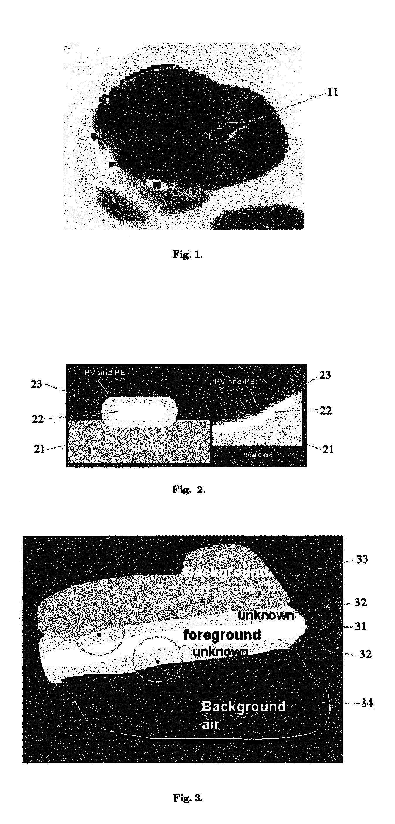 System and Method for Detecting Tagged Material Using Alpha Matting