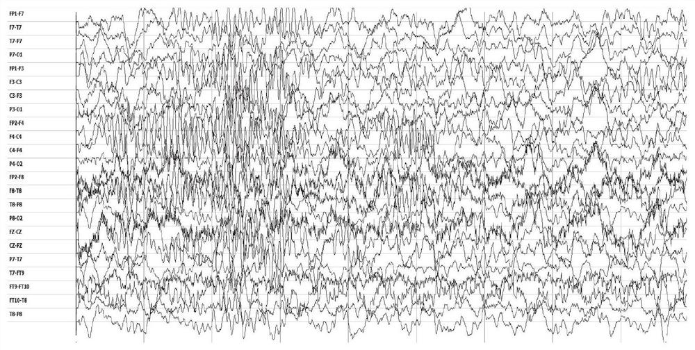 Multi-dimensional enhanced epileptic seizure prediction system based on graph convolutional network