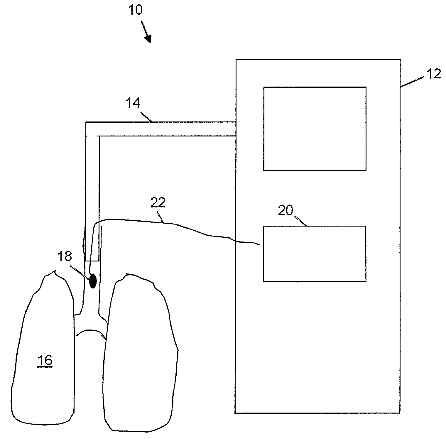 Apparatus, System and Method for Assessing Alveolar Inflation