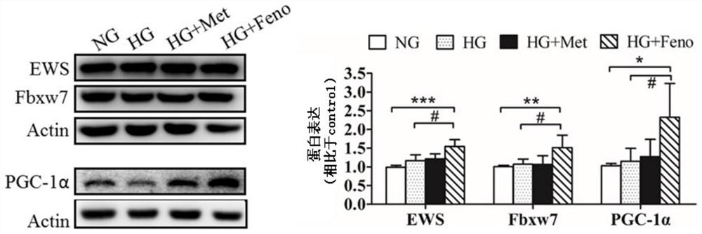 Application of up-regulator of hr or nhej pathway in preparation of medicines for treating diabetes and preventing tumor occurrence in diabetic individuals