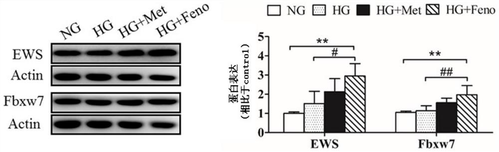 Application of up-regulator of hr or nhej pathway in preparation of medicines for treating diabetes and preventing tumor occurrence in diabetic individuals