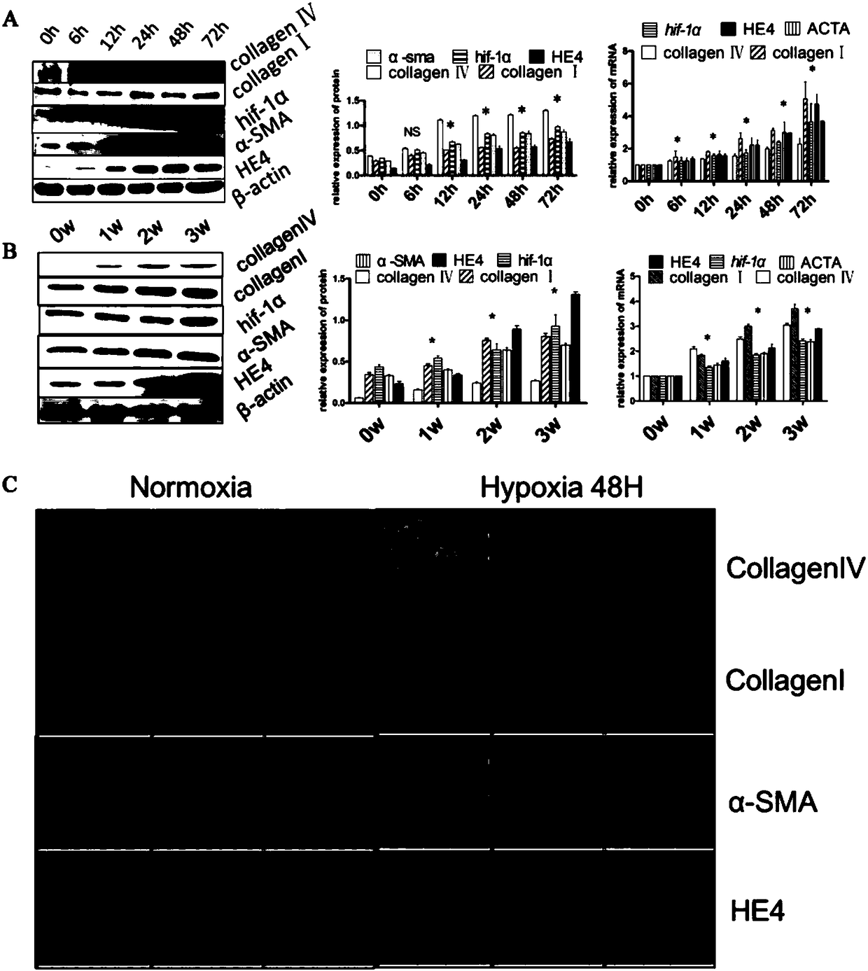 Application of human epididymal protein 4 in preparation of NF-[kappa]B agonist