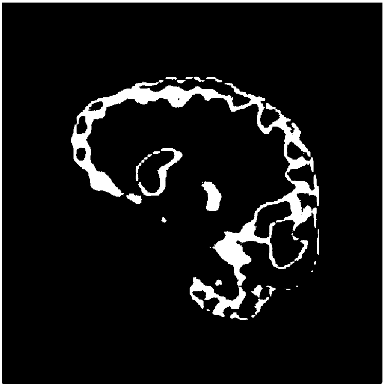 A medical image fusion method combining wavelet transform domain and space domain