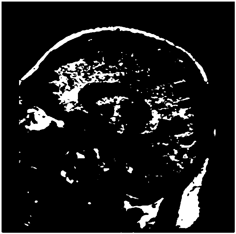 A medical image fusion method combining wavelet transform domain and space domain