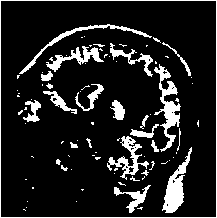 A medical image fusion method combining wavelet transform domain and space domain