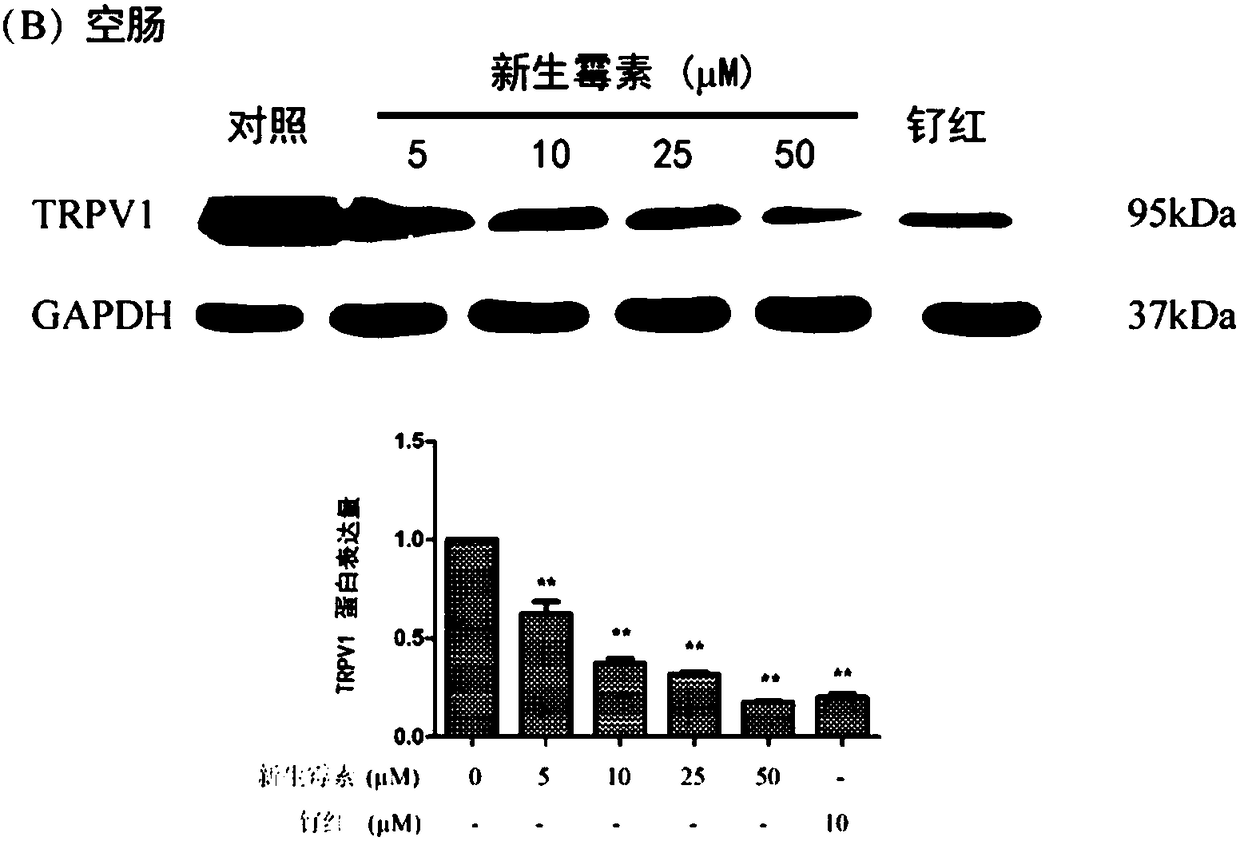 Application of novobiocin in preparation of drug with function of inhibiting TRPV1 (transient receptor potential cation channel, subfamily V, member 1) expression and transfer